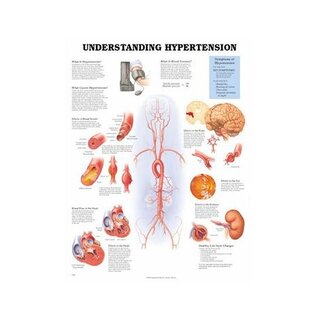 Poster laminato "Comprendere l'ipertensione" 51x66 cm