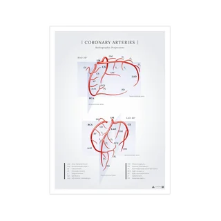 Poster sulle arterie coronarie del cuore viste nelle proiezioni radiografiche