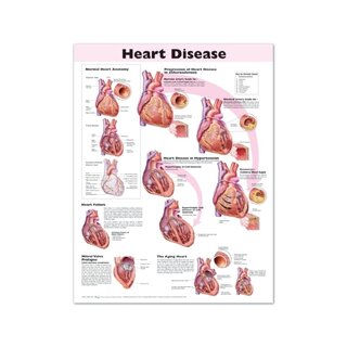 Poster laminato sulle malattie cardiache in inglese