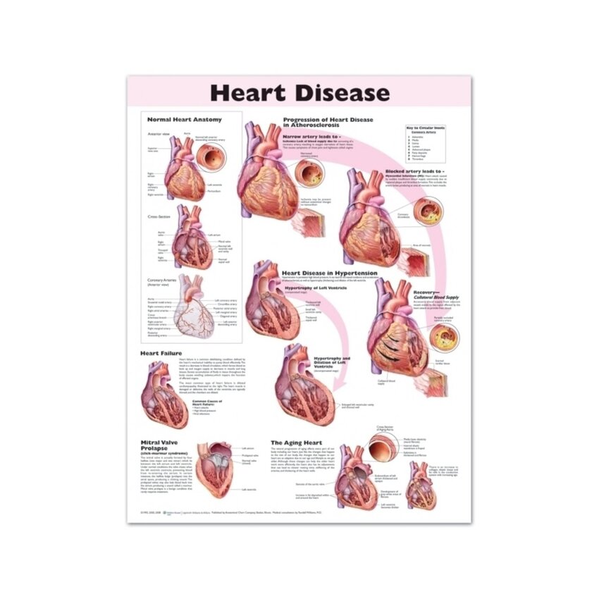 Poster laminato sulle malattie cardiache in inglese