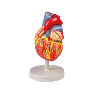 Cuore con bypass, 2x dimensioni naturali, 4 parti