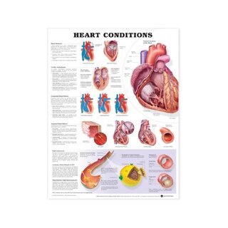 Poster laminato sulle malattie cardiache (condizioni cardiache)