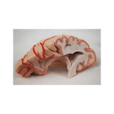 Cervello in 8 parti con arterie nella testa divisa