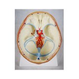 Cervello in 8 parti con arterie nella testa divisa