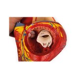 Cuore umano, 2 volte la dimensione naturale, 4 parti