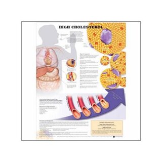 Poster laminato con fori ad anello per colesterolo alto